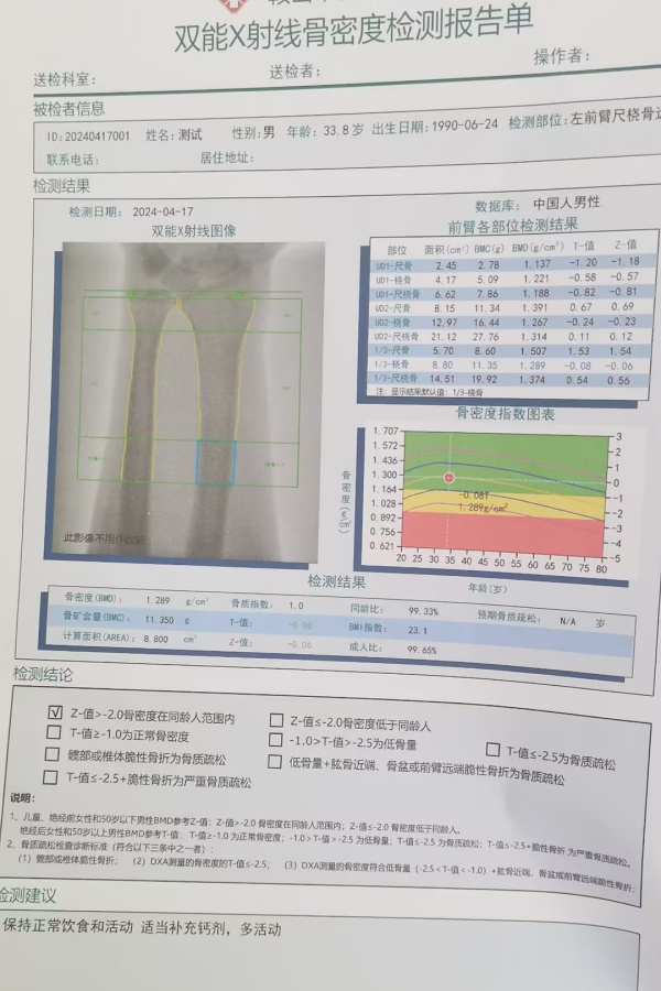 雙能X射線骨密度儀：準確測量骨密度，助力骨質(zhì)疏松防治，守護骨骼健康